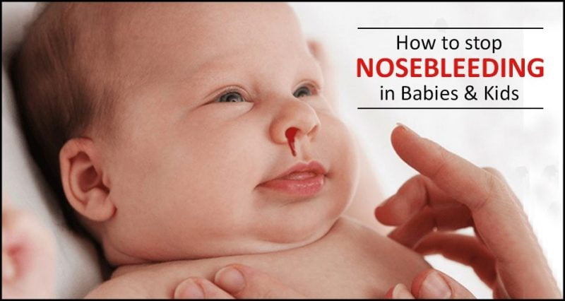 Nosebleed In Babies Why It Is Caused And How To Control Loving Parents