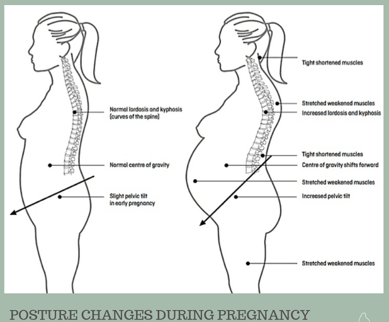 Lower Back And Left Side Pain During Pregnancy